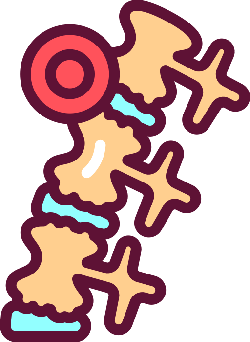 Ankylosing Spondylitis Treatment