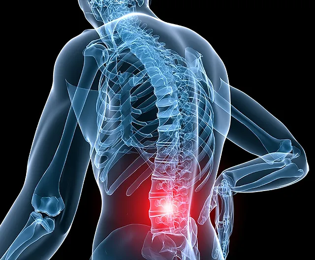 Back Pain Treatment