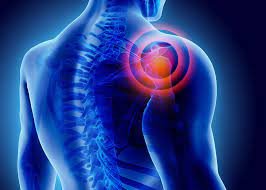 Frozen shoulder Physiotherapy